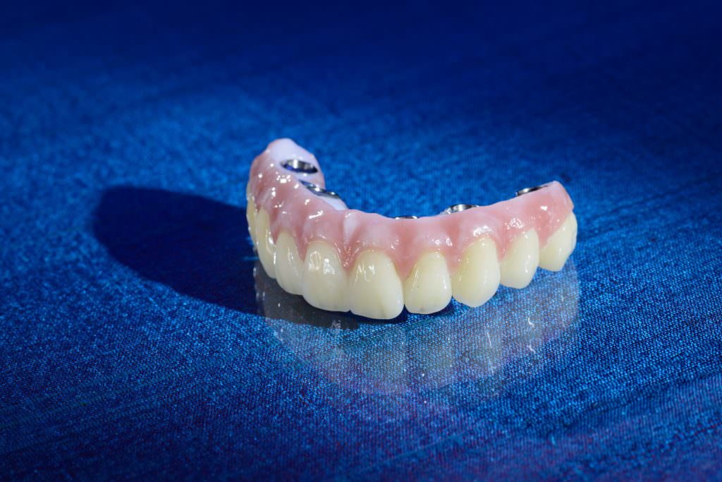 Протезирование зубов в казани. Титановые зубные протезы. Титановый съемный протез.